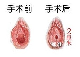 ޸ŮĤҪעʲô
